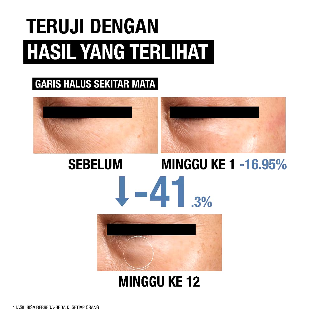 Johnson & Johnson Indonesia Neutrogena® Visible Repair Eye Cream