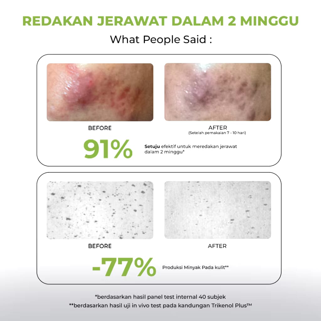 Facetology Innovation Technology Facetology Triple Care Acne Calm Moisturizer