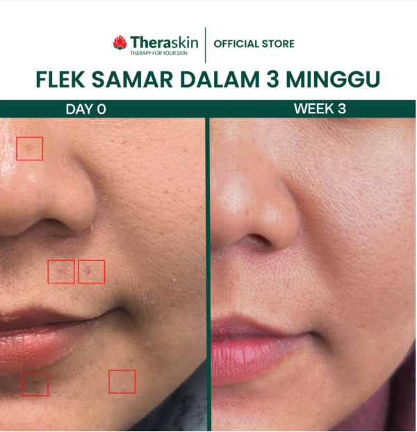 L'Essential Theraskin AHA 10 Cream