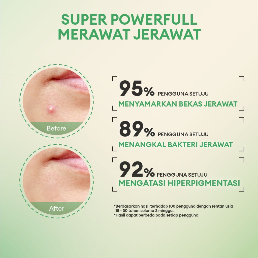 Animate by Yunna Mercier Animate Acne Care Serum