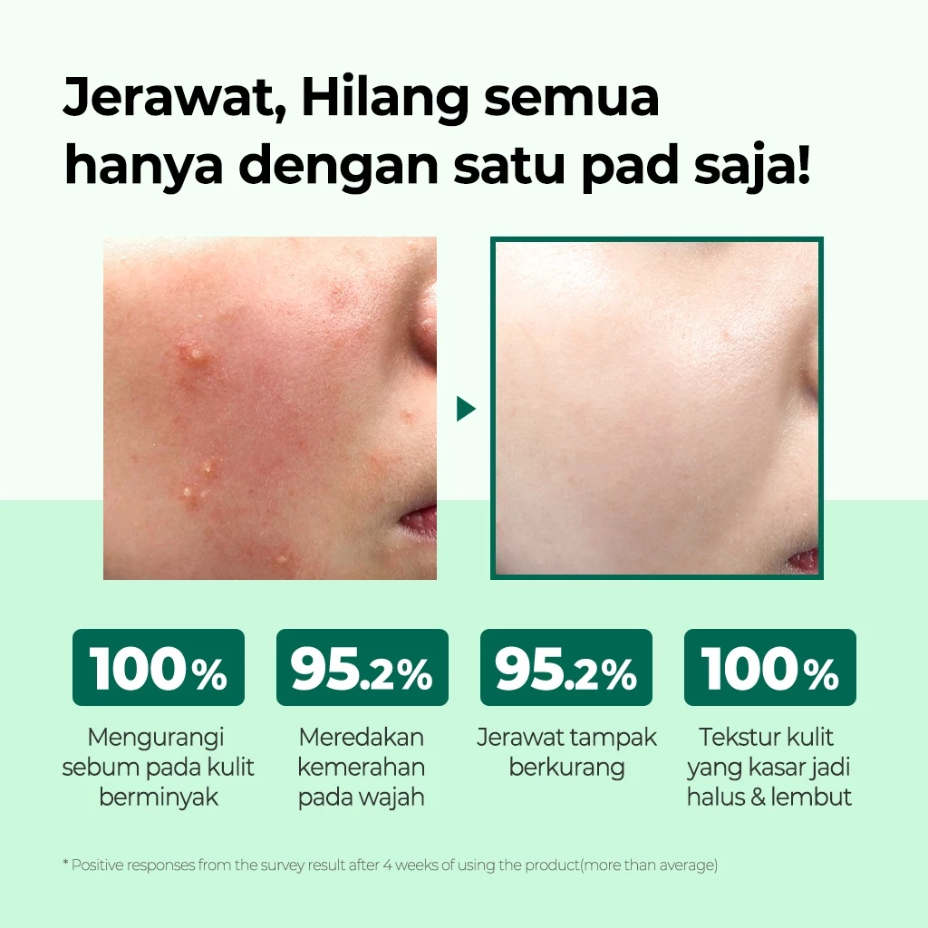 Perennbell SOME BY MI AHA BHA PHA 30 Days Miracle Truecica Clear Pad