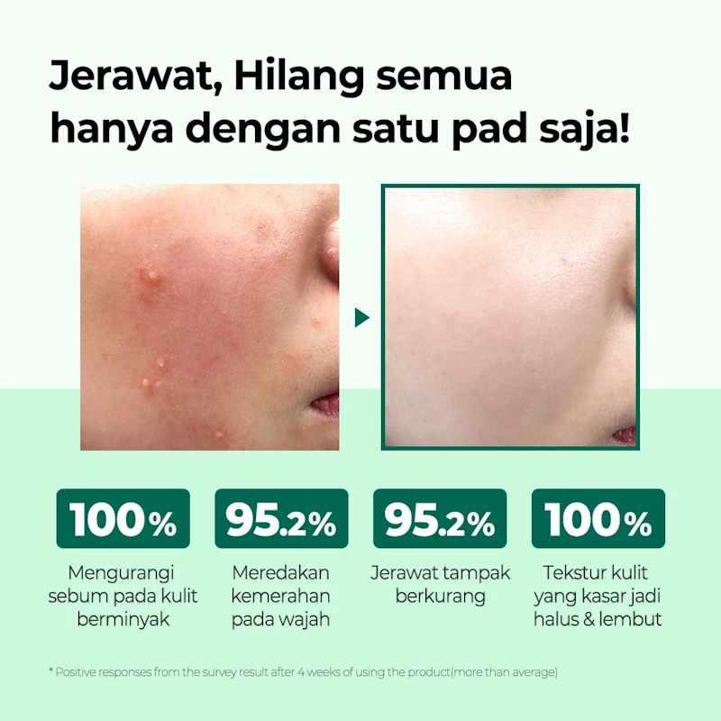 AHA BHA PHA 30 Days Miracle Truecica Clear Pad 4