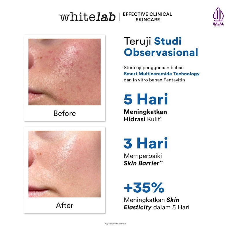 Ceramug Barrier Water Moisturizer 5