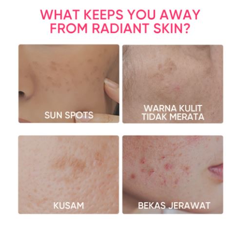 SKINTIFIC  SKINTIFIC MSH Niacinamide Brightening Moisture Gel