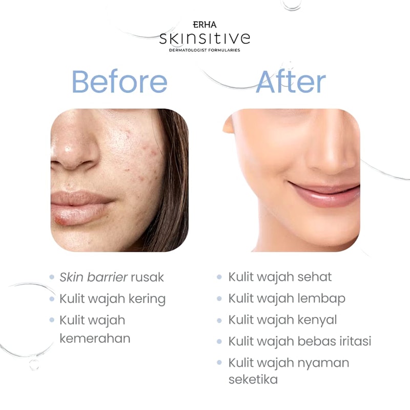 Ultracalm Skin Barrier Face Moisturizer 5