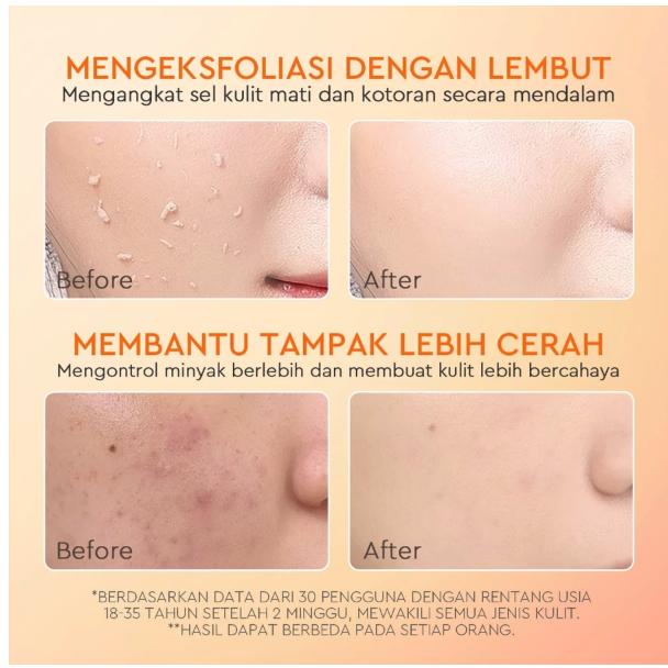  Suntone Wisdom Indonesia Glad2Glow Apricot Glycolic Acid Exfo Smooth Peeling Gel