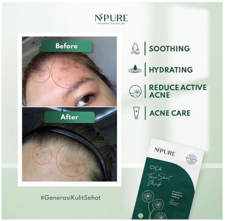 Penta Natural Kosmetindo N'PURE Cica Face Sheet Mask