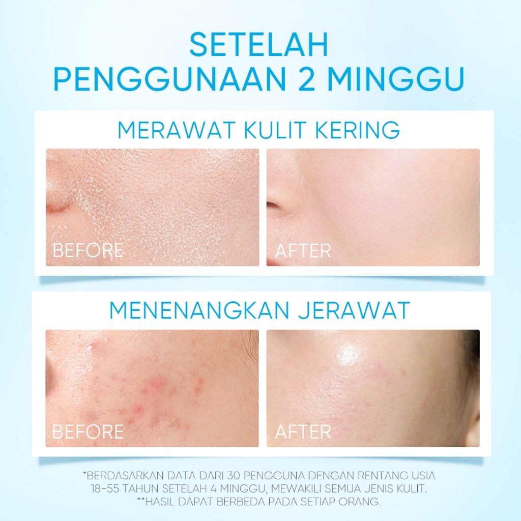 SKINTIFIC Cosmetics SKINTIFIC 5X Ceramide Barrier Moisturizer Gel