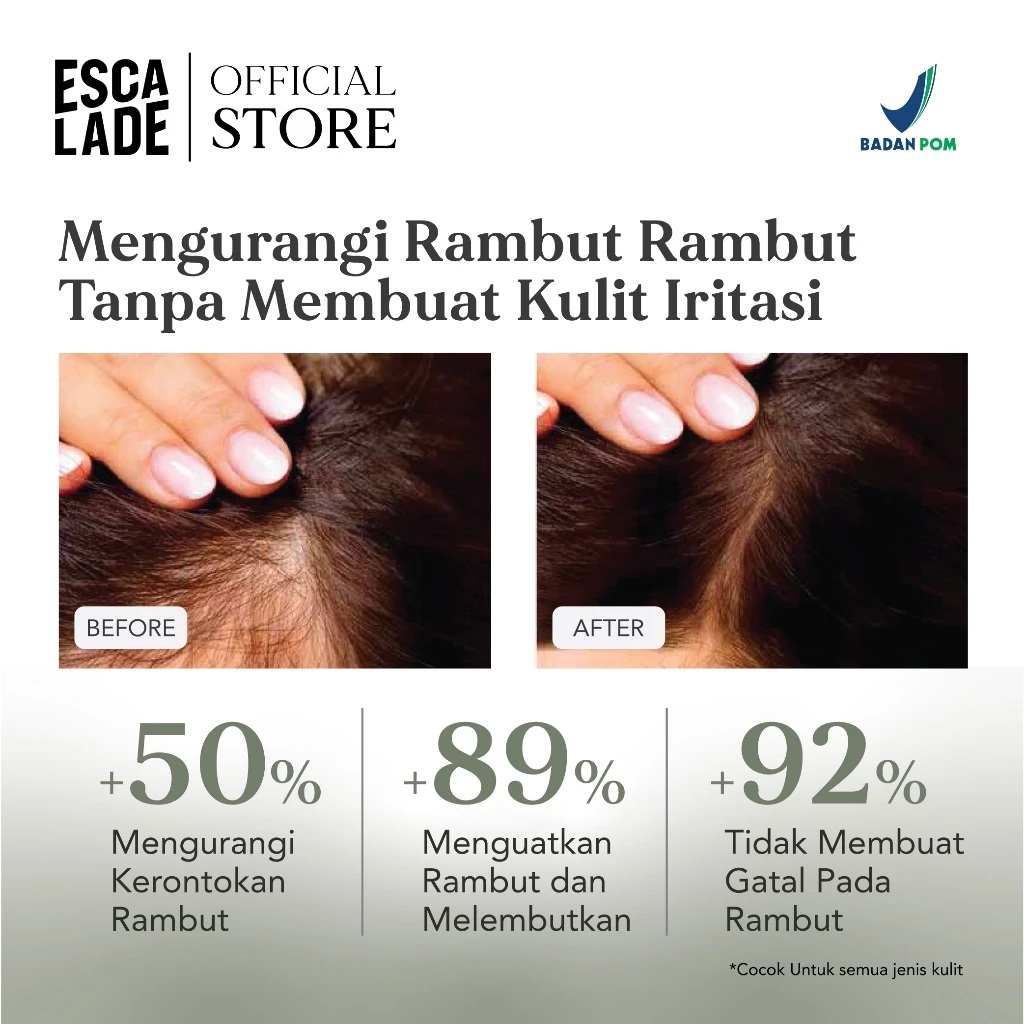 Escalade Hair Loss Shampoo 4