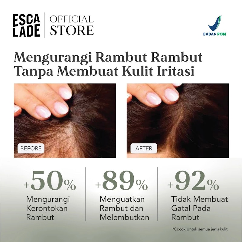Escalade Hair Loss Shampoo 4