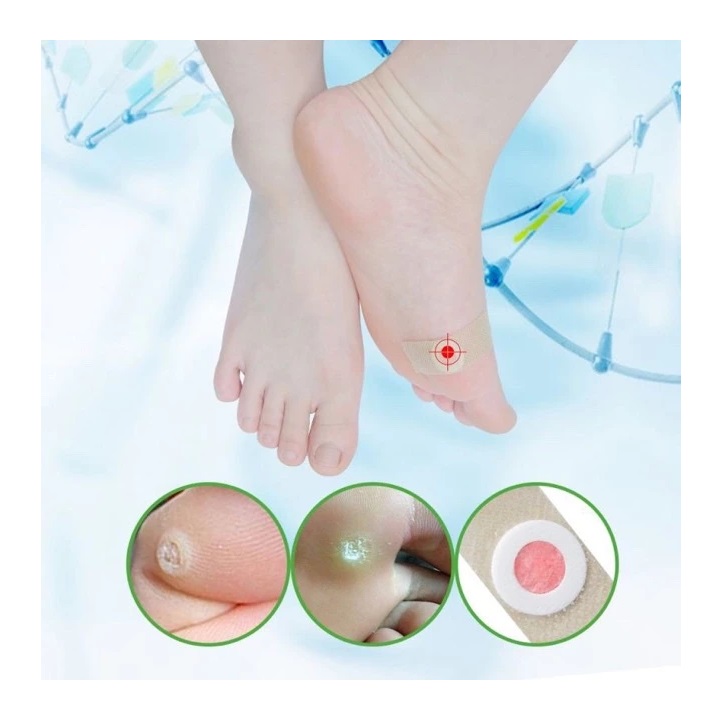  Sumifun Foot Corn Removal Plaster
