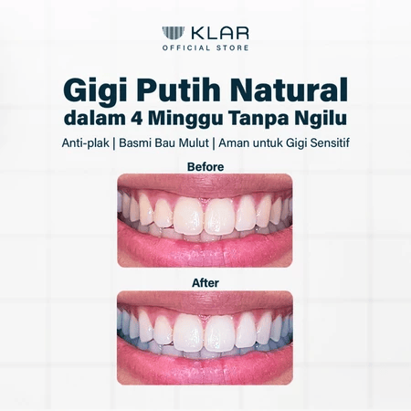 KLAR Intensewhite PAP+ Toothpaste