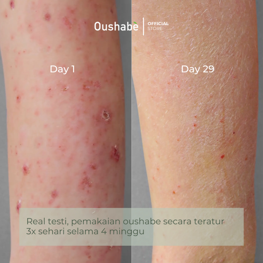 Oushabe Oushabe Dark Spot & Scar Therapy