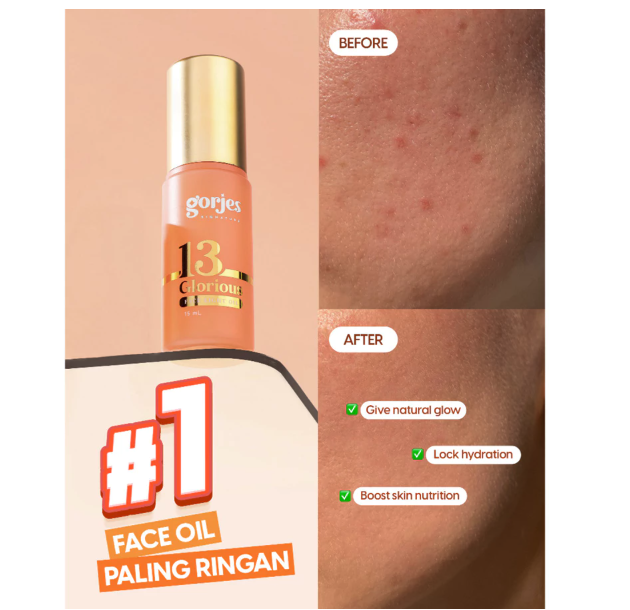 Royal Trijaya Visindo KOErx Gorjes 13 Glorious