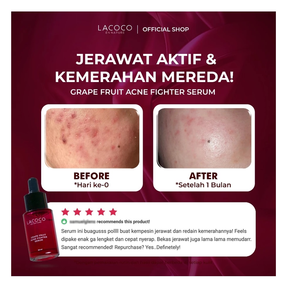 AVO Innovation Technology Lacoco Grape Fruit Acne Fighter Serum