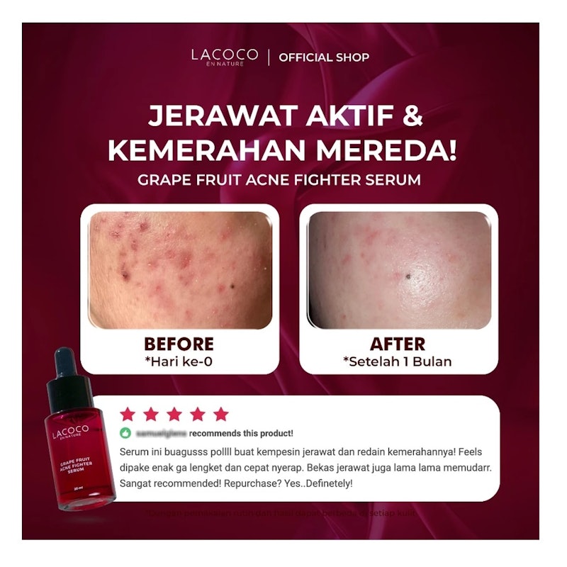 Grape Fruit Acne Fighter Serum 5