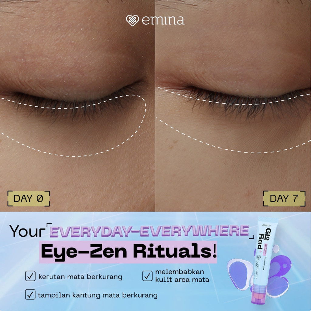 Paragon Technology and Innovation Emina GloRad+ Instant Refresh Puffy Eyes Eye Wake Up Roller