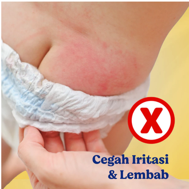 Softex Indonesia Sweety Bronze Dry X-Pert Pants M