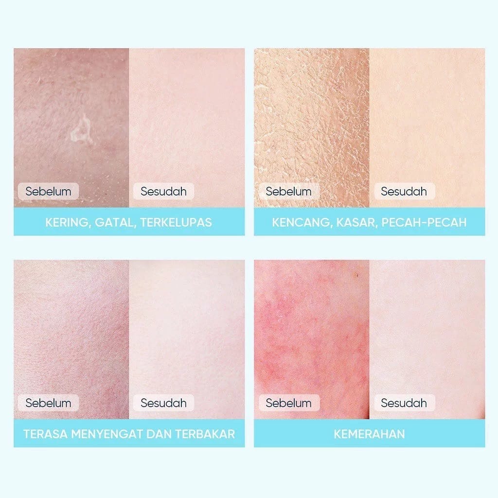 Skintific Cosmetics SKINTIFIC 5X Ceramide Soothing Sheet Mask