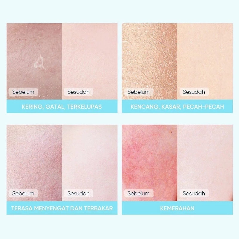 5X Ceramide Soothing Sheet Mask 5