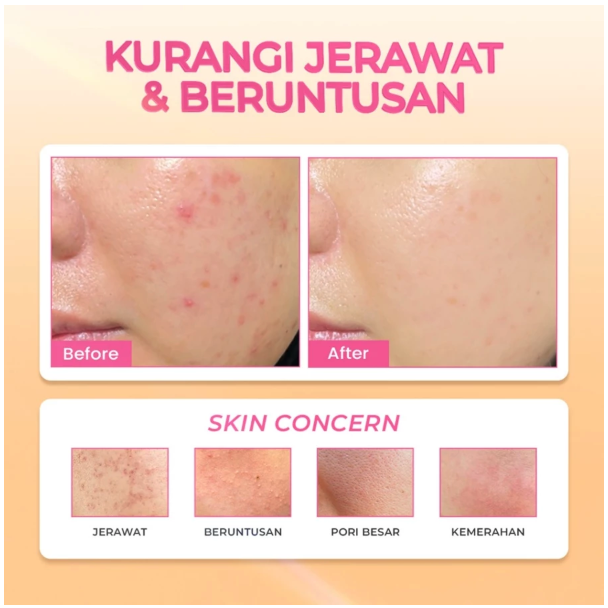 Eka Jaya Internasional Hanasui Power Acne Serum