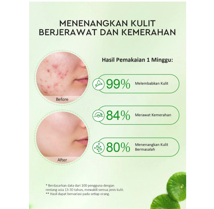 Suntone Wisdom Indonesia Glad2Glow Centella Allantoin Soothing Gel Moisturizer