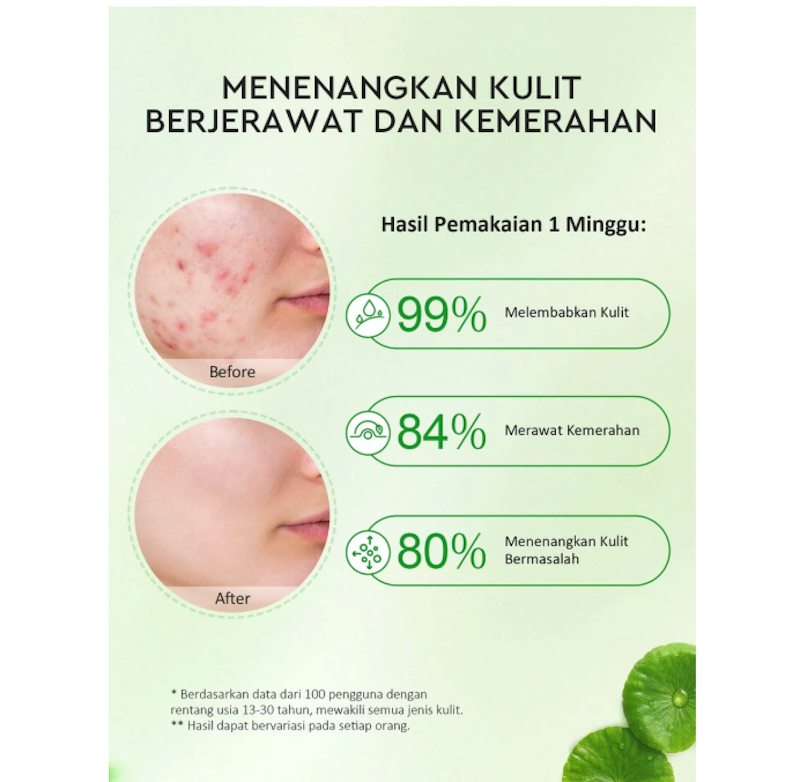 Glad2Glow Centella Allantoin Soothing Gel Moisturizer 4