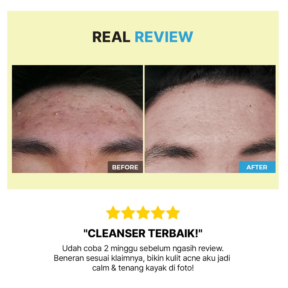 COSRX COSRX AC Low pH Good Morning Gel Cleanser