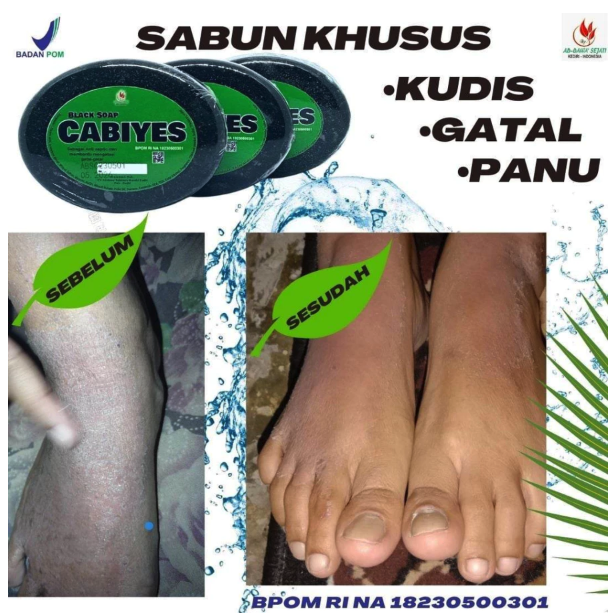 ADDAWA Sejahtera Mandiri CABIYES Black Soap