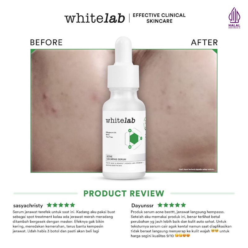 Acne Calming Serum 3