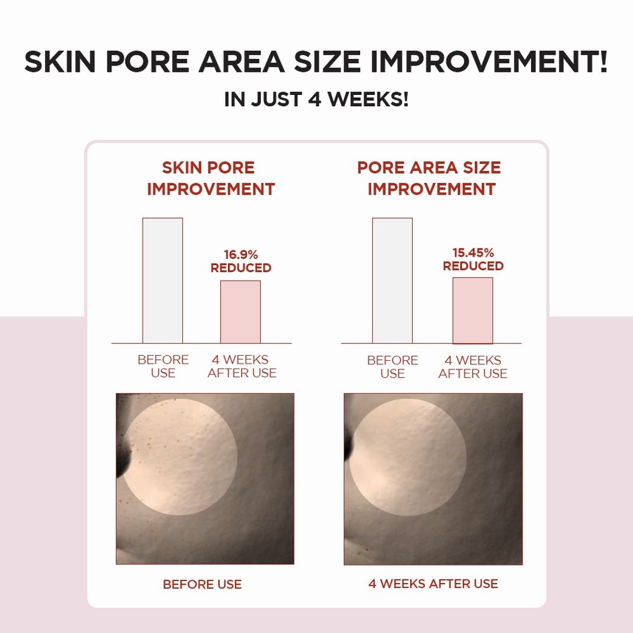 SKIN1004  SKIN1004 Madagascar Centella Poremizing Fresh Ampoule