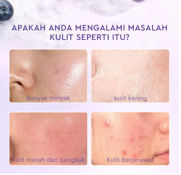 Suntone Wisdom Indonesia Glad2Glow Blueberry Ceramide Low pH Gel Cleanser