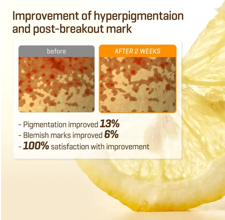 Perennbell SOME BY MI Yuja Niacin Anti Blemish Serum