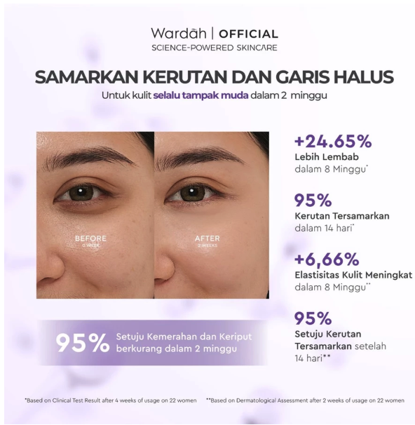 Wardah Renew You Retinol Microcaps Matrixyl™ 3000 Lift & Rejuvenate Night Moisturizer