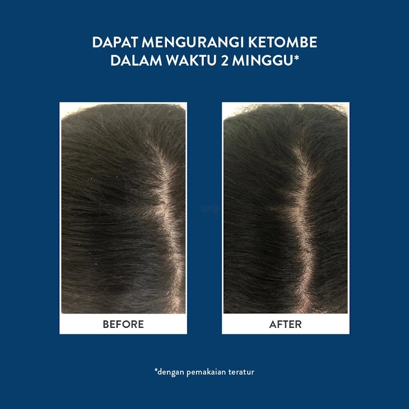 Eucalie Organic Hair Treatment Shampoo 3