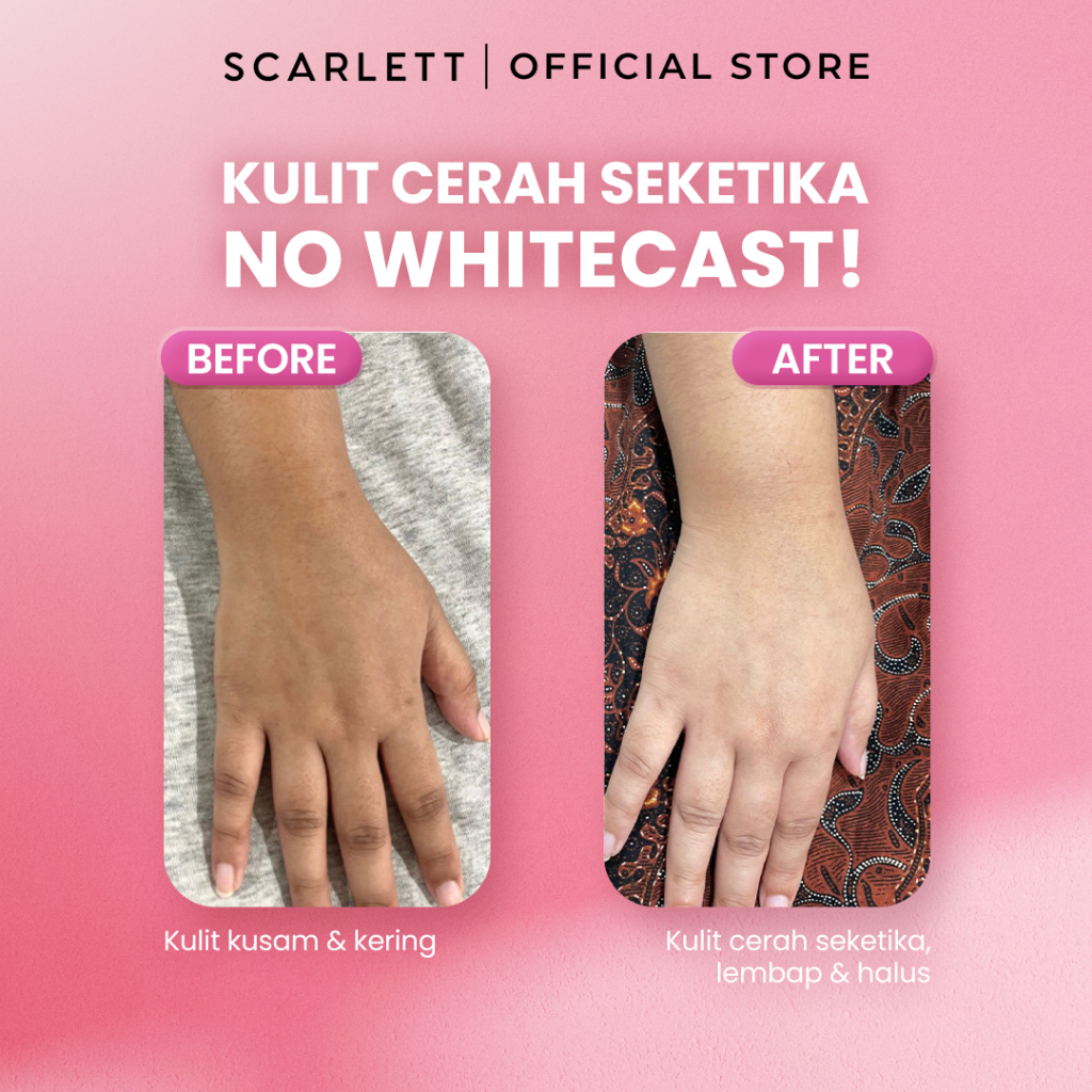 Opto Lingkar Sejahtera Scarlett Whitening Fragrance Brightening Body Lotion Jolly