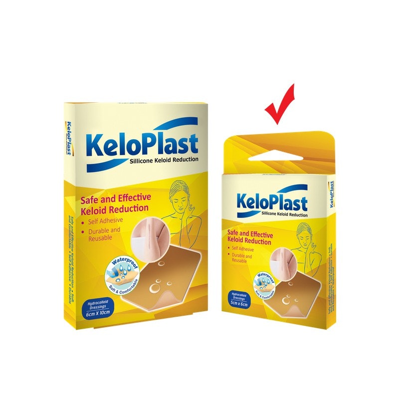 Keloplast Silicone Keloid Reduction 3