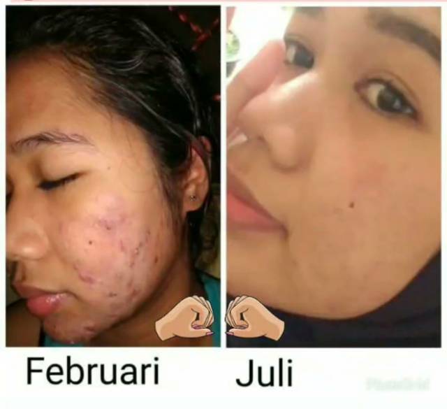 Nose Herbalindo Falabelle Tamanu Oil