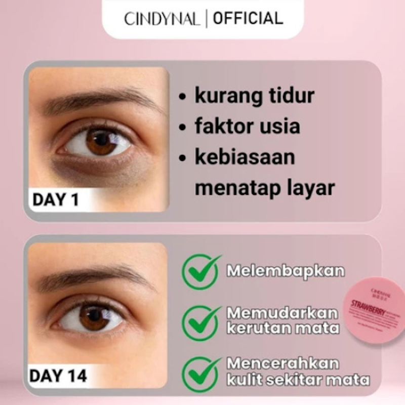 CYNDINAL Strawberry Moisturizing Eye Mask 4