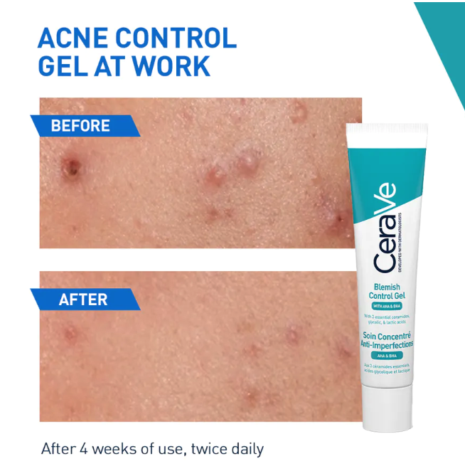 L'Oréal Indonesia CeraVe Blemish Control Gel 