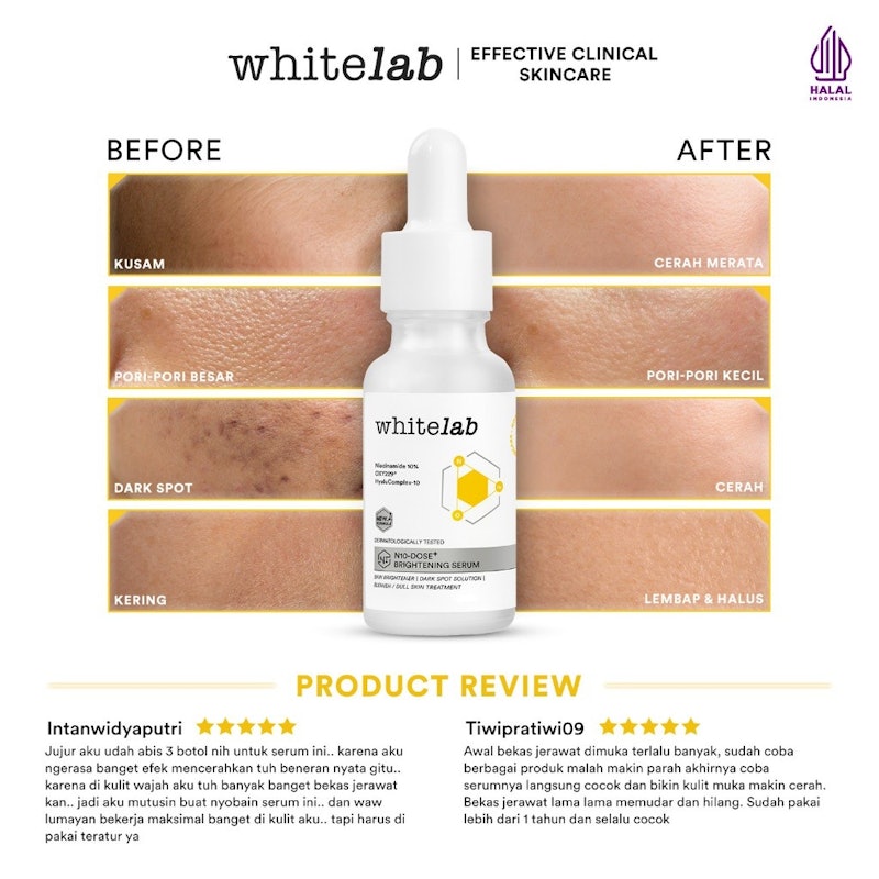 N10-Dose+ Brightening Serum Niacinamide 10% 5