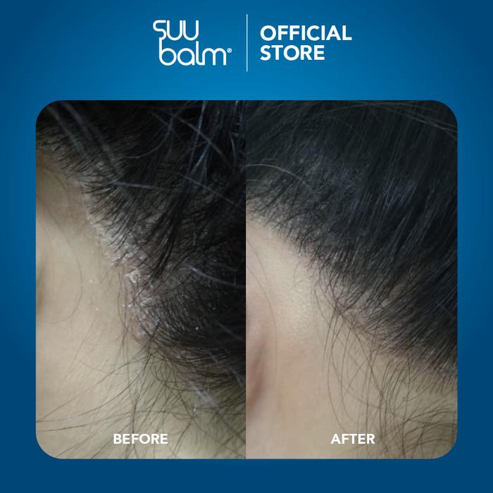 Good Pharma Dermatology Suu Balm Gentle Moisturising Anti Dandruff Shampoo