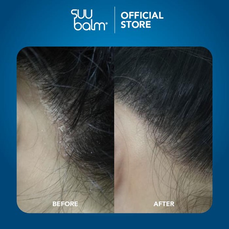 Suu Balm Gentle Moisturising Anti Dandruff Shampoo 3