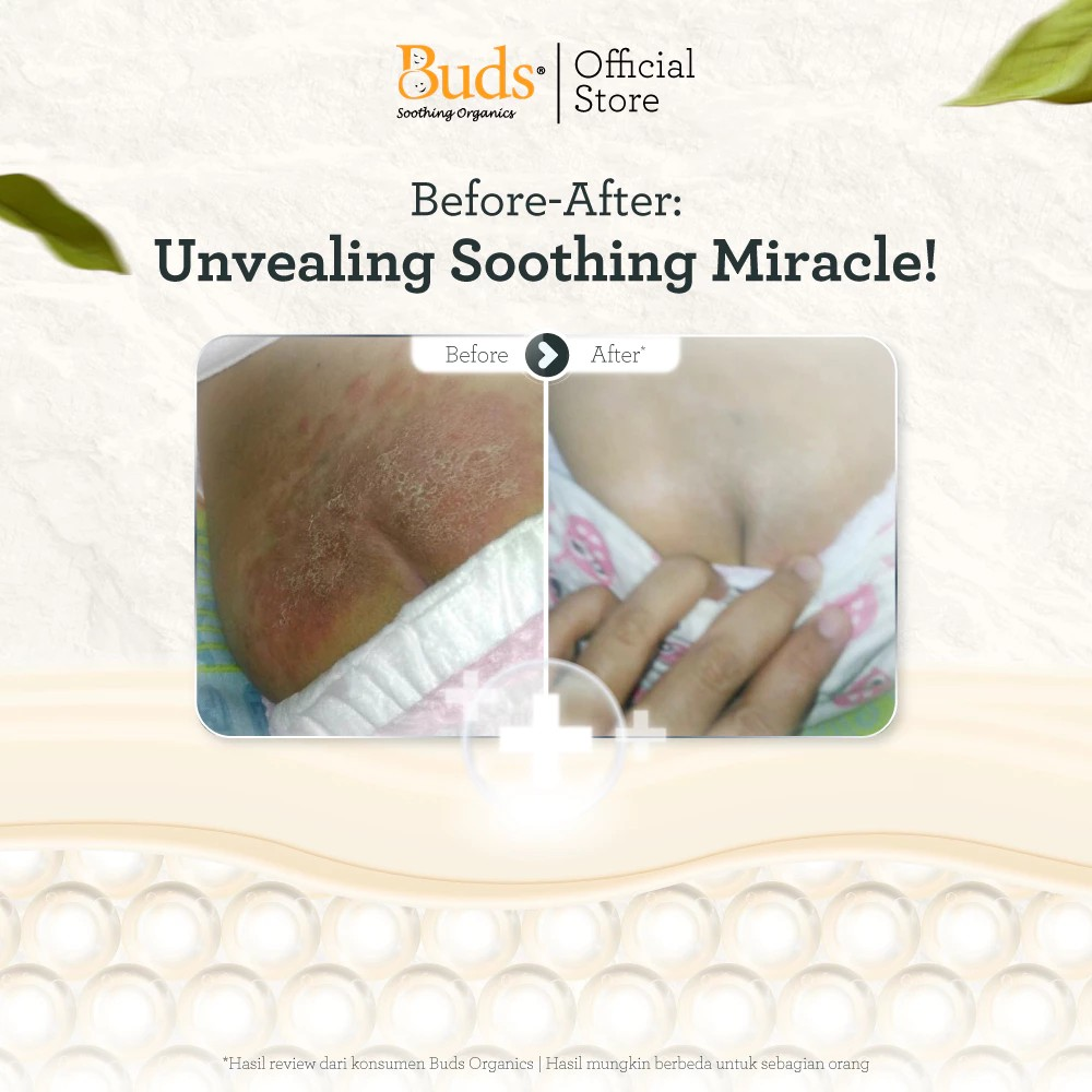 Buds Organics Indonesia Buds® Organics Nappy Time Soothing Cream