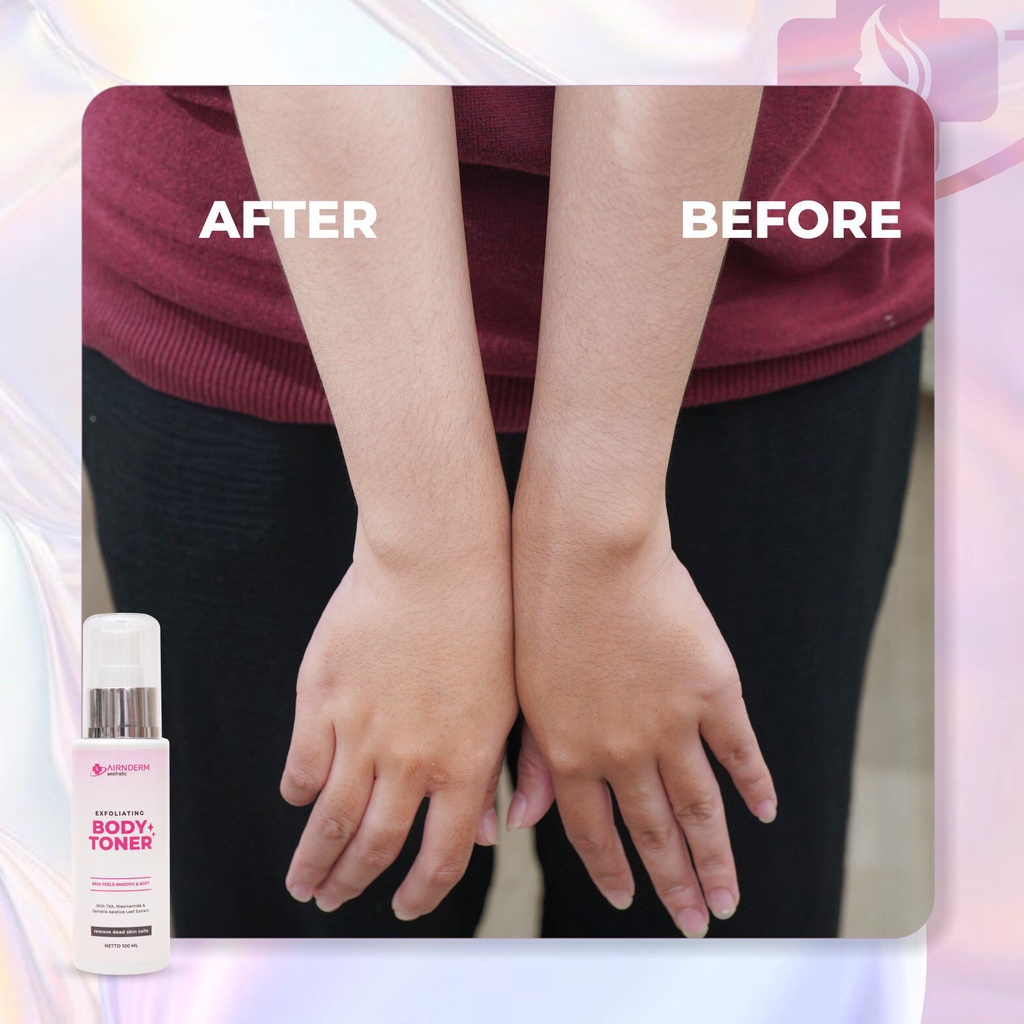 Airnderm Aesthetic Exfoliating Body Toner