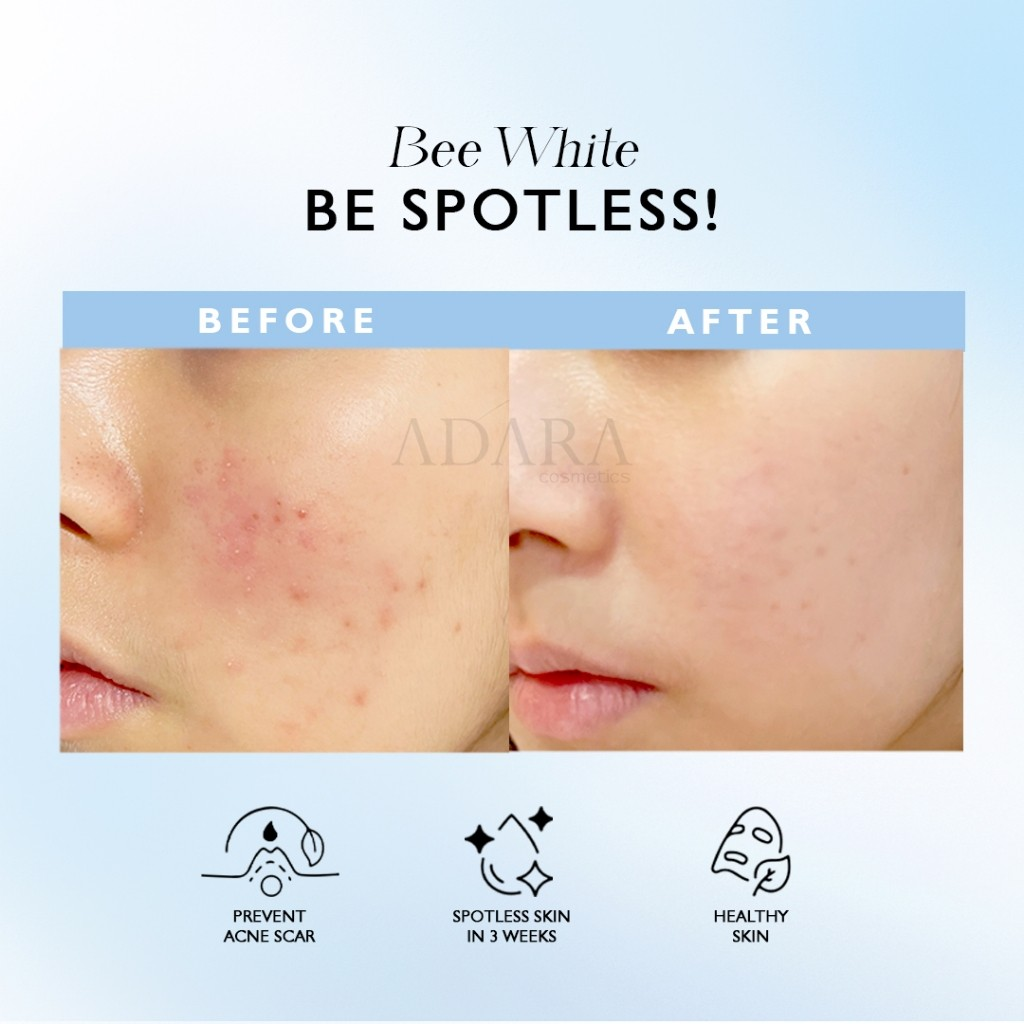 Adara Cosmetic and Beauty Care Adara Cosmetics Bee White Spotless Cream