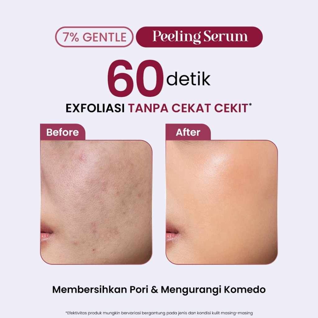 Natura Deca Kosmetika White Story 7% Gentle Peeling Serum