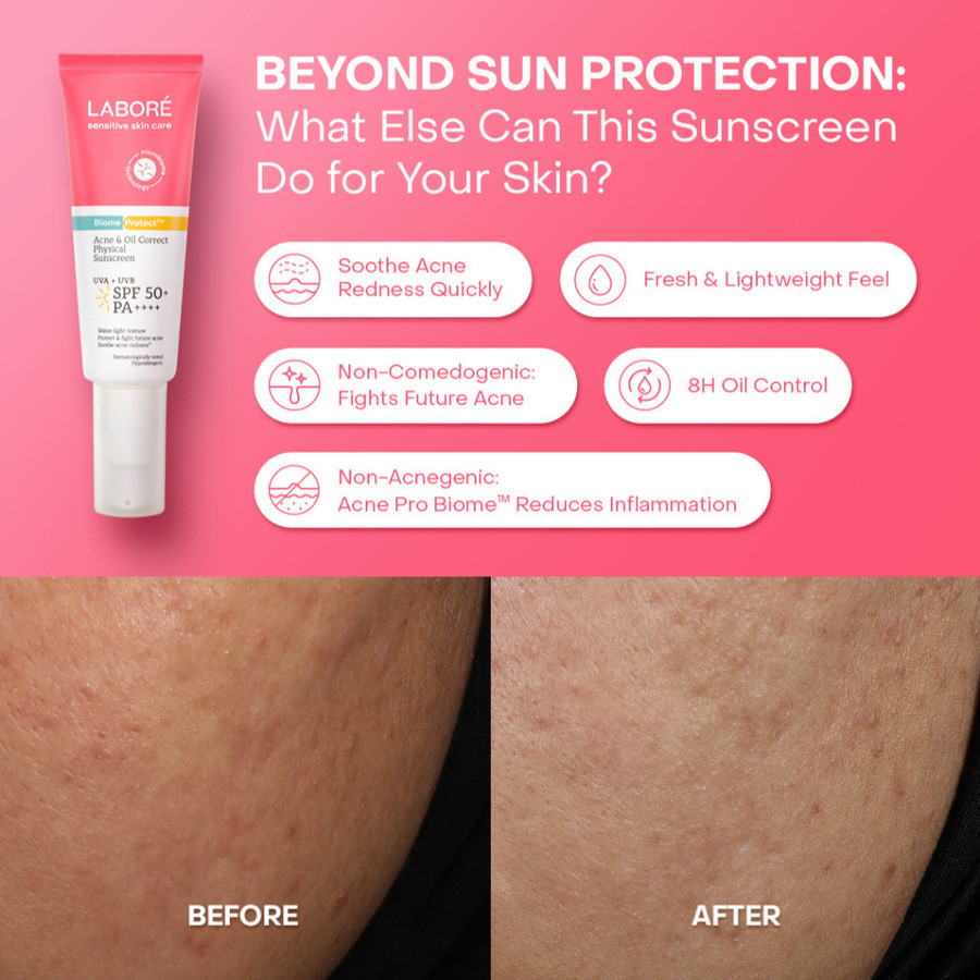 Paragon Technology and Innovation LABORÉ BiomeProtect™ Acne & Oil Correct Physical Sunscreen