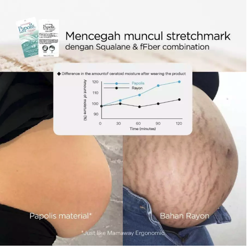 Mamaway Korset Hamil Penyangga Perut Ergonomic 3