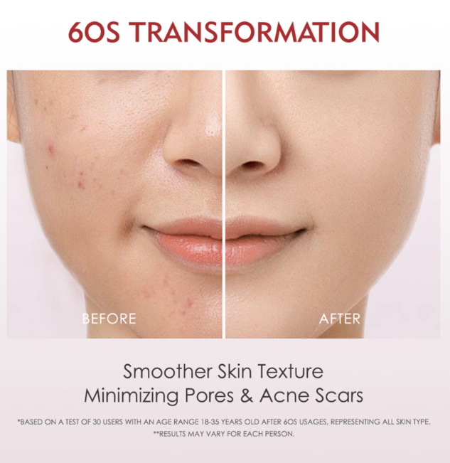 Guangzhou Fumei Biotechnology Elformula Intensive Peeling Solution